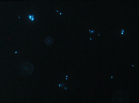 天然海水中の微生物を使った試験：細胞内の核酸染色（DAPI） 微生物試験区